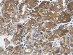 Invitrogen Cystatin C Monoclonal Antibody (C14):Antibodies:Primary Antibodies