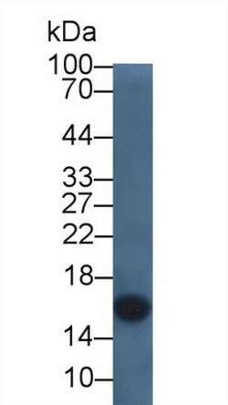 Invitrogen Cystatin C Monoclonal Antibody (C14):Antibodies:Primary Antibodies