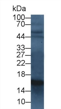 Invitrogen Cystatin C Monoclonal Antibody (C14):Antibodies:Primary Antibodies