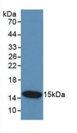 Invitrogen Cystatin C Monoclonal Antibody (C14):Antibodies:Primary Antibodies