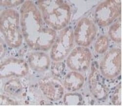Invitrogen PLA2G4A Monoclonal Antibody (C19):Antibodies:Primary Antibodies