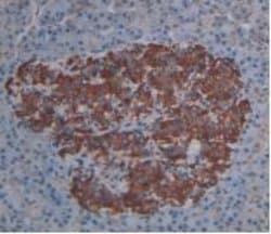 Invitrogen PLA2G4A Monoclonal Antibody (C19):Antibodies:Primary Antibodies