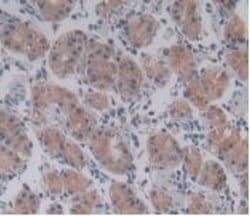 Invitrogen PLA2G4A Monoclonal Antibody (C19):Antibodies:Primary Antibodies