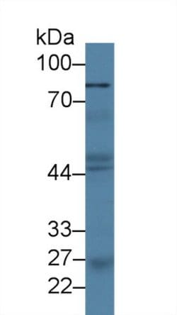 Invitrogen PLA2G4A Monoclonal Antibody (C19):Antibodies:Primary Antibodies