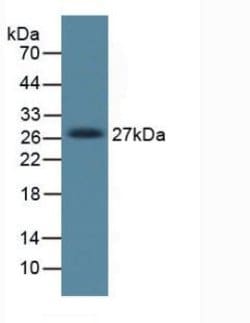 Invitrogen DKK1 Monoclonal Antibody (C5):Antibodies:Primary Antibodies