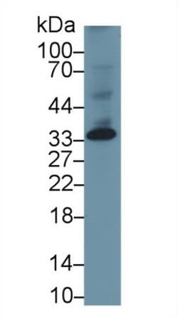 Invitrogen DKK1 Monoclonal Antibody (C5):Antibodies:Primary Antibodies