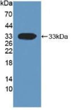 Invitrogen DKK1 Monoclonal Antibody (C5):Antibodies:Primary Antibodies