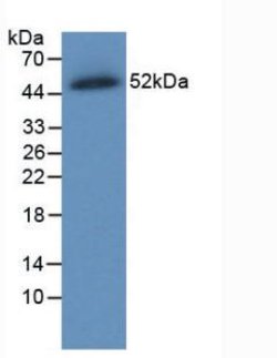 Invitrogen Ferroportin Monoclonal Antibody (C7):Antibodies:Primary Antibodies