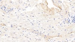 Invitrogen Fibrinogen Beta Chain Monoclonal Antibody (2#) 200 &mu;L; Unconjugated:Antibodies,
