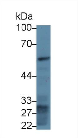 Invitrogen Fibrinogen Beta Chain Monoclonal Antibody (2#) 200 &mu;L; Unconjugated:Antibodies,
