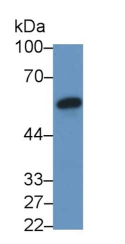 Invitrogen Fibrinogen Beta Chain Monoclonal Antibody (2#) 200 &mu;L; Unconjugated:Antibodies,