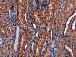 Invitrogen alpha Galactosidase Monoclonal Antibody (C8):Antibodies:Primary