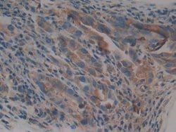Invitrogen alpha Galactosidase Monoclonal Antibody (B1) 200 &mu;L; Unconjugated:Antibodies,