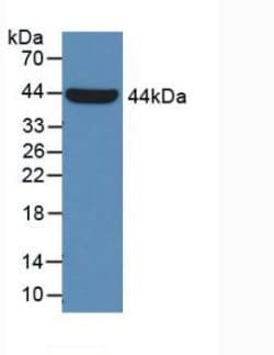 Invitrogen alpha Galactosidase Monoclonal Antibody (B1) 200 &mu;L; Unconjugated:Antibodies,