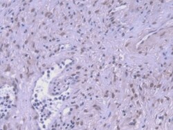 Invitrogen HSPA1A Monoclonal Antibody (2#):Antibodies:Primary Antibodies
