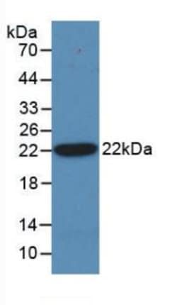 Invitrogen SHH Monoclonal Antibody (C4) 20 &mu;L; Unconjugated:Antibodies,