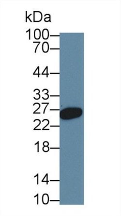 Invitrogen HFE2 Monoclonal Antibody (A7) 20 &mu;L; Unconjugated:Antibodies,