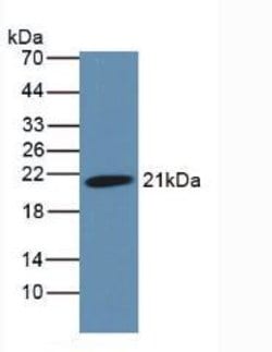 Podocin Monoclonal Antibody (C3), Invitrogen:Antibodies:Primary Antibodies