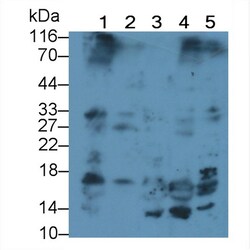 Invitrogen IGF1 Monoclonal Antibody (C1) 200 &mu;L; Unconjugated:Antibodies,