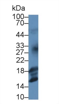 Invitrogen IGF1 Monoclonal Antibody (C1) 200 &mu;L; Unconjugated:Antibodies,