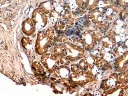 Invitrogen IGFBP-1 Monoclonal Antibody (D9):Antibodies:Primary Antibodies