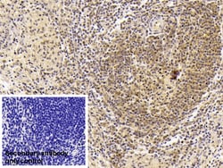 Invitrogen IGFBP-1 Monoclonal Antibody (D9):Antibodies:Primary Antibodies