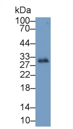 Invitrogen IGFBP-1 Monoclonal Antibody (D9):Antibodies:Primary Antibodies