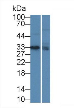 Invitrogen IGFBP-1 Monoclonal Antibody (D9):Antibodies:Primary Antibodies