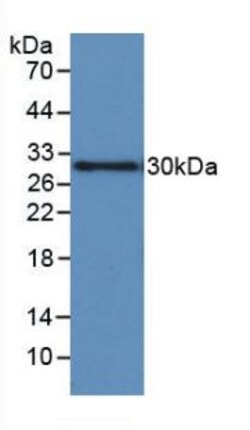 Invitrogen IGFBP-1 Monoclonal Antibody (D9):Antibodies:Primary Antibodies