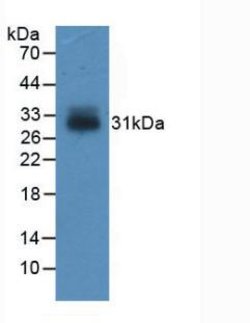 Invitrogen IGFBP4 Monoclonal Antibody (C15) 200 &mu;L | Buy Online | Invitrogen&trade; | Fisher Scientific