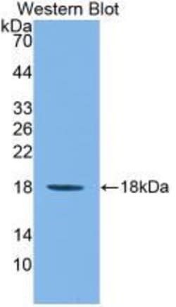 Invitrogen IL1F9 Monoclonal Antibody (D2):Anticorps:Anticorps primaires