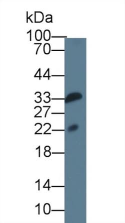 Invitrogen IL1F9 Monoclonal Antibody (D2):Anticorps:Anticorps primaires