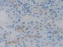 Invitrogen IL-12 p35 Monoclonal Antibody (C1) 200 &mu;L; Unconjugated:Antibodies,