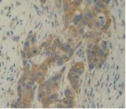 Invitrogen IL-12 p35 Monoclonal Antibody (C1) 200 &mu;L; Unconjugated:Antibodies,