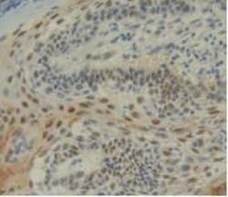 Invitrogen IL-12 p35 Monoclonal Antibody (C1) 200 &mu;L; Unconjugated:Antibodies,
