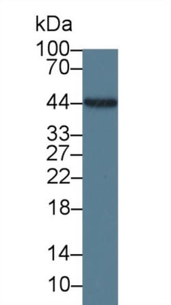 Invitrogen IL-19 Monoclonal Antibody (C3) 20 &mu;L | Buy Online | Invitrogen&trade; | Fisher Scientific