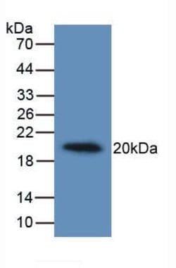 Podocin Monoclonal Antibody (C3), Invitrogen:Antibodies:Primary Antibodies
