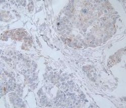 Invitrogen IL-19 Monoclonal Antibody (C9):Antibodies:Primary Antibodies