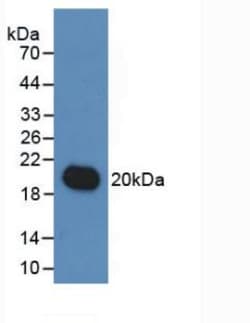 Invitrogen IL-19 Monoclonal Antibody (C9) 200 &mu;L; Unconjugated:Antibodies,