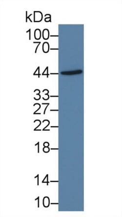 Invitrogen IL-19 Monoclonal Antibody (C9):Antibodies:Primary Antibodies