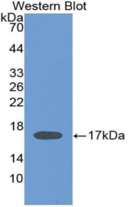 Invitrogen IL-2 Monoclonal Antibody (C5):Antibodies:Primary Antibodies