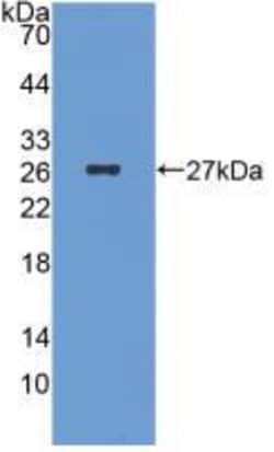 Invitrogen ICA1 Monoclonal Antibody (C7):Antibodies:Primary Antibodies