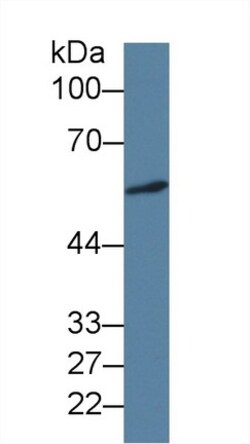 Invitrogen ICA1 Monoclonal Antibody (C7) 200 &mu;L | Buy Online | Invitrogen&trade; | Fisher Scientific