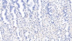 Invitrogen LSR Monoclonal Antibody (C2):Antibodies:Primary Antibodies