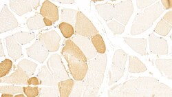 Invitrogen LSR Monoclonal Antibody (C2) 200 &mu;L; Unconjugated:Antibodies,