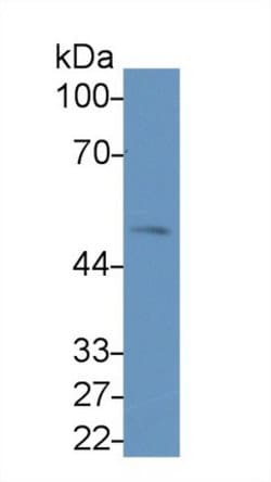 Invitrogen LSR Monoclonal Antibody (C2):Antibodies:Primary Antibodies