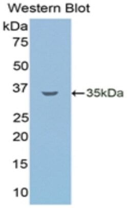 Invitrogen LSR Monoclonal Antibody (C2) 200 &mu;L; Unconjugated:Antibodies,