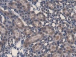 Invitrogen LPS Monoclonal Antibody (C6):Antibodies:Primary Antibodies