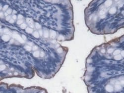 Invitrogen LPS Monoclonal Antibody (C8):Antibodies:Primary Antibodies