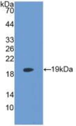 Invitrogen LPCAT3 Monoclonal Antibody (6-2#):Antibodies:Primary Antibodies